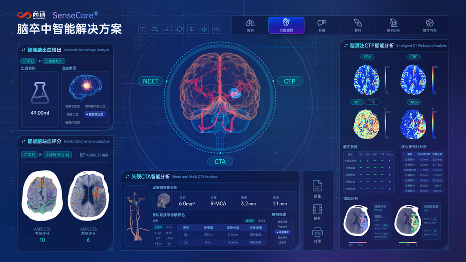 AI辅助诊断(医疗影像识别)(ai智能医疗辅助系统)